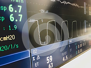 A patient`s vital signs monitor in an operating theatre.