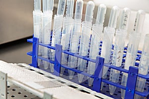 Patient samples ready to prepare slides for karyotype and fluorescence in situ hybridization at the laboratory