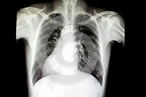 a patient with situs inversus