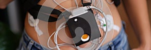 Patient standing with holter electrocardiogram monitor closeup