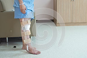 Patient standing with support of knee brace and plaster after pcl ligament knee surgery in orthopedic ward hospital,recovery and