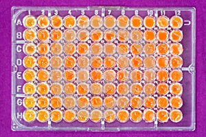 Pcr well plate on 96 well microplate with biological samples