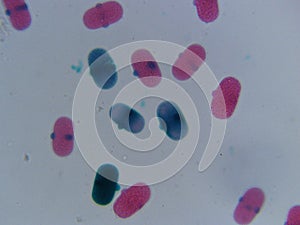 Pea Pollen 400x Pink and Blue