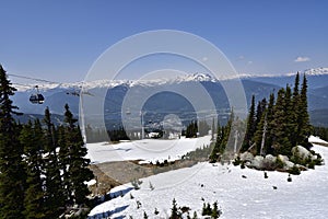 Peak 2 Peak gondola building on top of Whistler Blackcomb Mountain