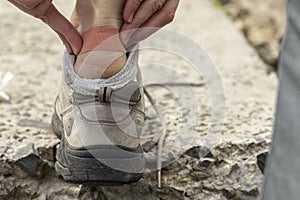 A pedestrian tourist glues a patch on his foot.