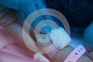 Pediatrician hold a baby's hand, under ultraviolet lamp