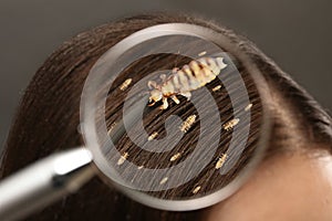 Pediculosis. Woman with lice and nits, closeup. View through magnifying glass on hair