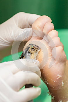 Pedicure procedure in the beauty salon. emover calluses on the