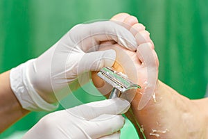 Pedicure procedure in the beauty salon. emover calluses on the photo