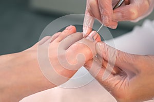 Pedicurist is cleaning nails from dry skin and dirt on toes using metal stick.