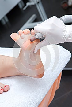 Peeling feet pedicure procedure