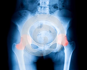 pelvic bone with pain symptoms