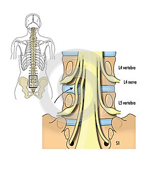 Pelvic nerve roots