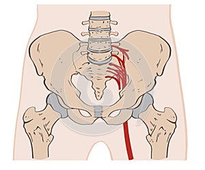 The pelvis consists of the sacrum, the coccyx,the ischium, the ilium, and the pubis.