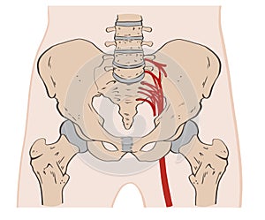 The pelvis consists of the sacrum, the coccyx,the ischium, the ilium, and the pubis. photo