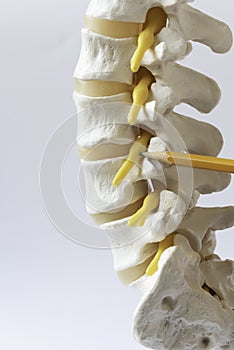 A pencil pointing at lumbar nerve root