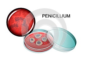 Penicillin mold, in a Petri dish and under a microscope