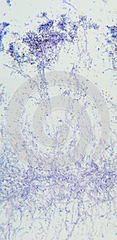 Penicillium, ascomycetous fungi, detail, under the microscope