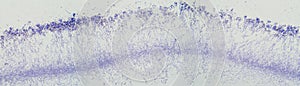 Penicillium, ascomycetous fungi, under the microscope
