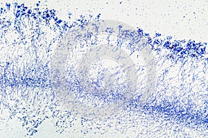 Penicillium, hyphae and mycelium magnified under a microscope photo