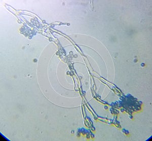 Penicillium genus mold mycelium under the microcope