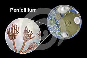 Penicillium mold fungi, illustration and photo of colony grown on nutrient medium