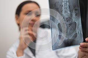 Pensive doctor analyzes X-ray picture of patient pelvis working in modern hospital