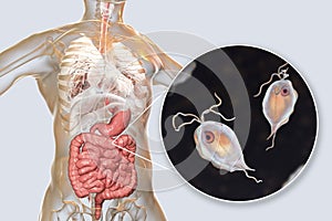 Pentatrichomonas hominis protozoan in human intestine