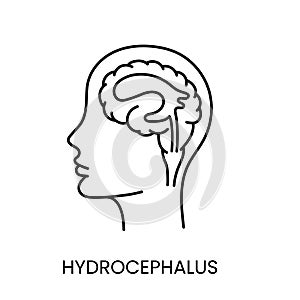 People with disabilities, hydrocephalus brain disease, line icon vector.