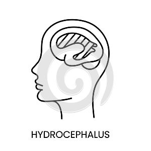 People with disabilities, hydrocephalus brain disease, line icon vector.