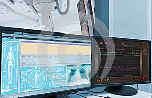 Percutaneous coronary intervention PCICardiac Catheterization with Coronary Angiography on blurry Cardiac Catherization Lab Room