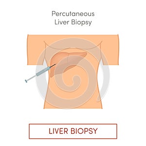 Percutaneous liver biopsy