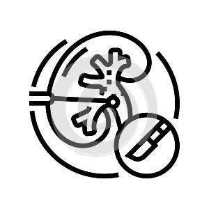 percutaneous nephrolithotomy line icon vector illustration photo