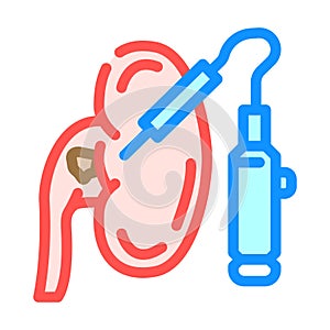 percutaneous nephrolithotomy surgery color icon vector illustration photo