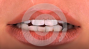 Perfect healthy teeth beautiful wide smile bleaching procedure whitening of young smiling attractive sexy lips woman. Dental