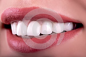 Perfect healthy teeth beautiful wide smile bleaching procedure whitening of young smiling attractive sexy lips woman. Dental