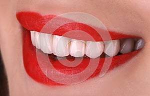 Perfect healthy teeth beautiful wide smile bleaching procedure whitening of young smiling attractive sexy red lips woman. Dental