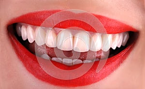 Perfect healthy teeth beautiful wide smile bleaching procedure whitening of young smiling attractive sexy red lips woman. Dental