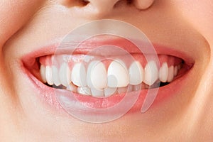 Perfect healthy teeth smile of a young woman. Teeth whitening. Dental care, stomatology concept.