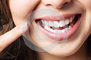 Perfect healthy teeth smile of a young woman. Teeth whitening. Dental clinic patient. Image symbolizes oral care