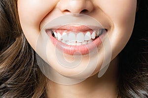 Perfect healthy teeth smile of a young woman. Teeth whitening. Dental clinic patient. Image symbolizes oral care