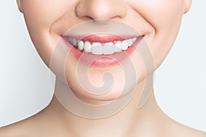 Perfect healthy teeth smile of a young woman. Teeth whitening. Dental clinic patient. Image symbolizes oral care
