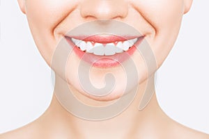 Perfect healthy teeth smile of a young woman. Teeth whitening. Dental clinic patient. Image symbolizes oral care