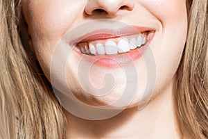 Perfect healthy teeth smile of a young woman. Teeth whitening. Dental clinic patient. Image symbolizes oral care