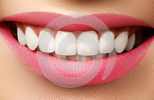 Perfect smile after bleaching. Dental care and whitening teeth