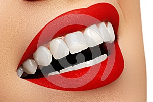 Perfect smile after bleaching. Dental care and whitening teeth.