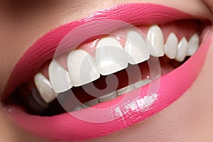 Perfect smile before and after bleaching. Dental care and whitening teeth. Smile with white healthy teeth. Healthy woman teeth