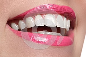 Perfect smile after bleaching. Dental care and whitening teeth. Woman smile with great teeth. Close-up of smile with white healthy