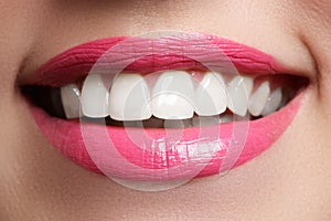 Perfect smile after bleaching. Dental care and whitening teeth. Woman smile with great teeth. Close-up of smile with white healthy