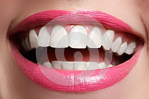 Perfect smile after bleaching. Dental care and whitening teeth. Woman smile with great teeth. Close-up of smile with white healthy